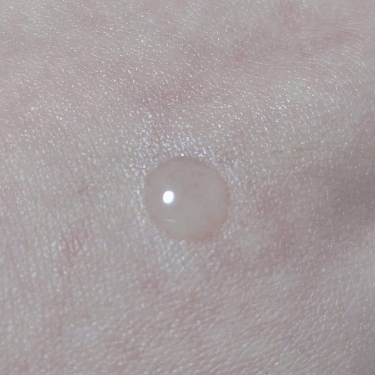 タカミスキンピール/タカミ/ブースター・導入液を使ったクチコミ(2枚目)