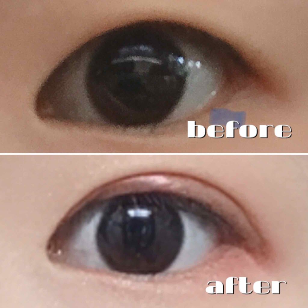 【旧品】オリシキ アイリッドスキンフィルム/D-UP/二重まぶた用アイテムを使ったクチコミ（1枚目）