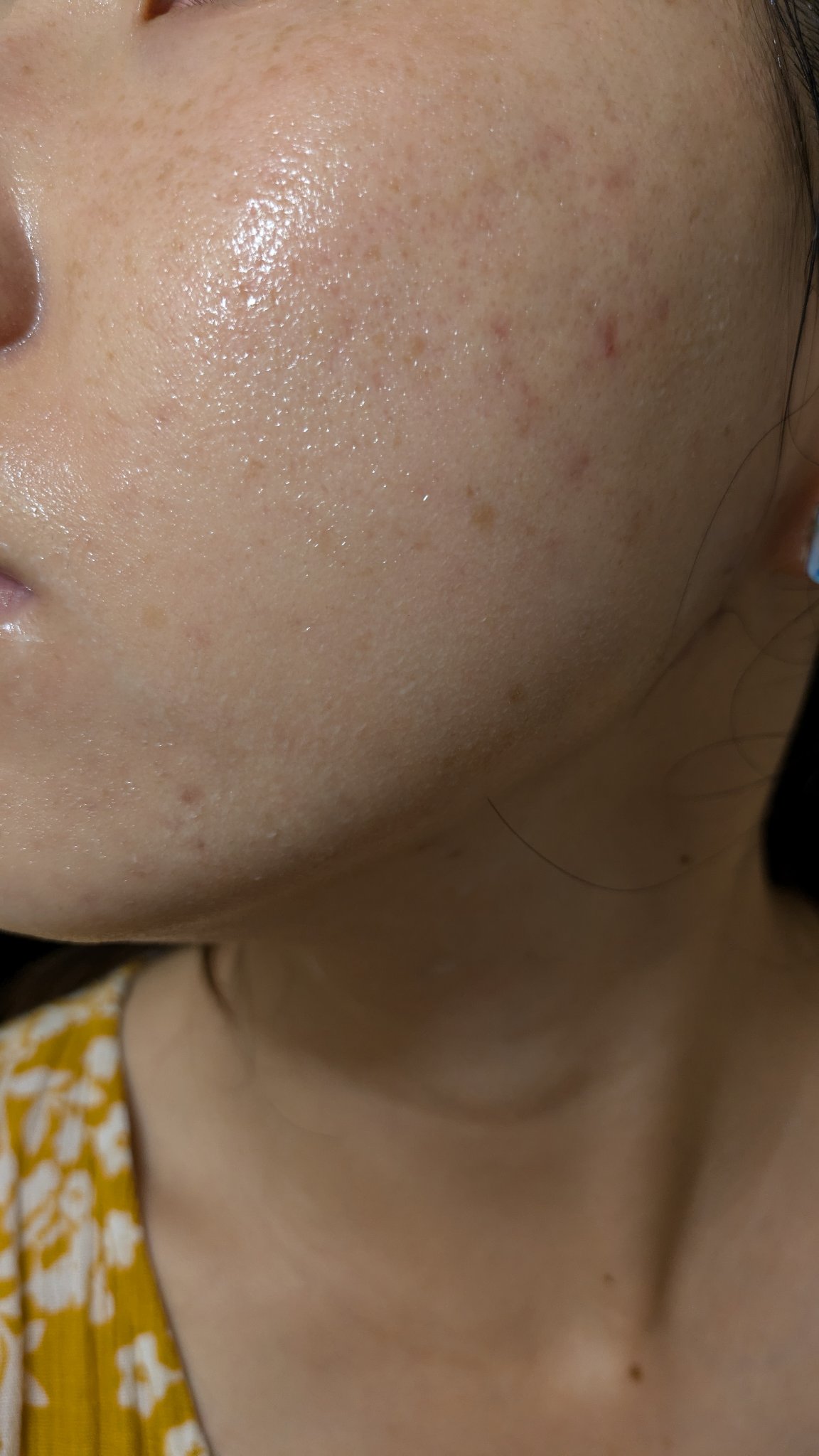 薬用リンクルナイトクリーム ホワイト/なめらか本舗/フェイスクリームを使ったクチコミ（2枚目）