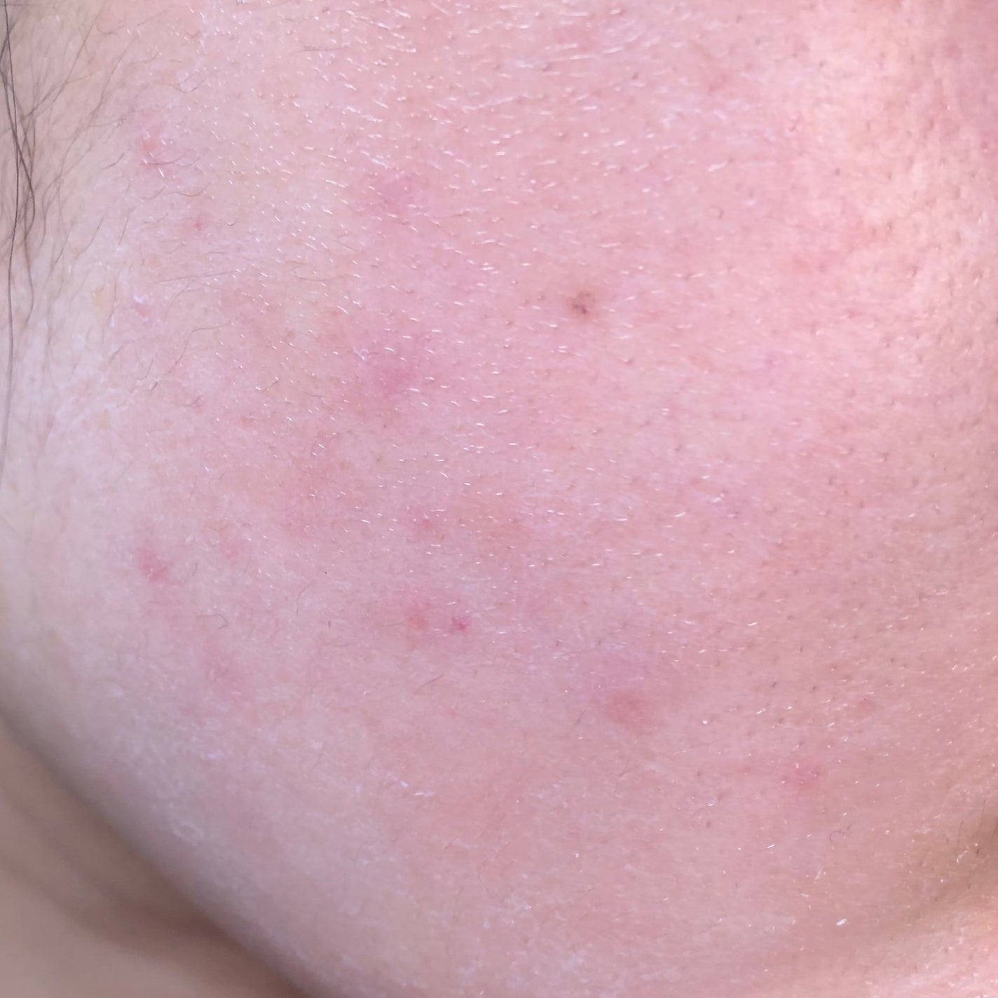 イプノス シーバムクリア リペアクリーム/ACSEINE/フェイスクリームを使ったクチコミ(3枚目)