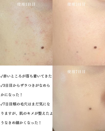 リードルS 300 2ステップマスク/VT/シートマスク・パックを使ったクチコミ(10枚目)