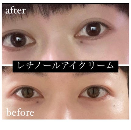 レチノールインテンシブ アドバンスドトリプルアクションアイクリーム/SOME BY MI/アイケア・アイクリームを使ったクチコミ(8枚目)