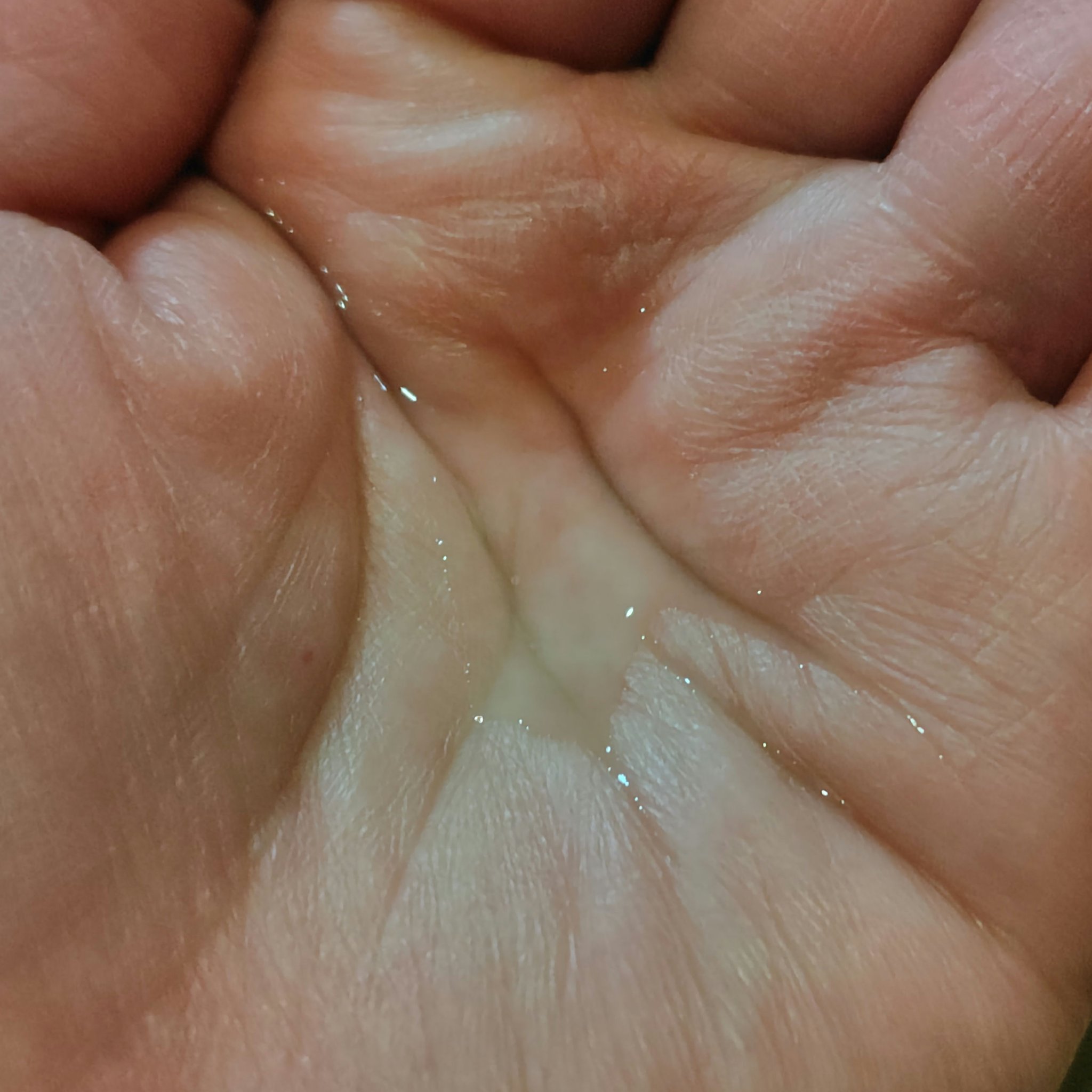 アロマエッセゴールド モイスチャーローション/aroma ess./化粧水を使ったクチコミ（3枚目）