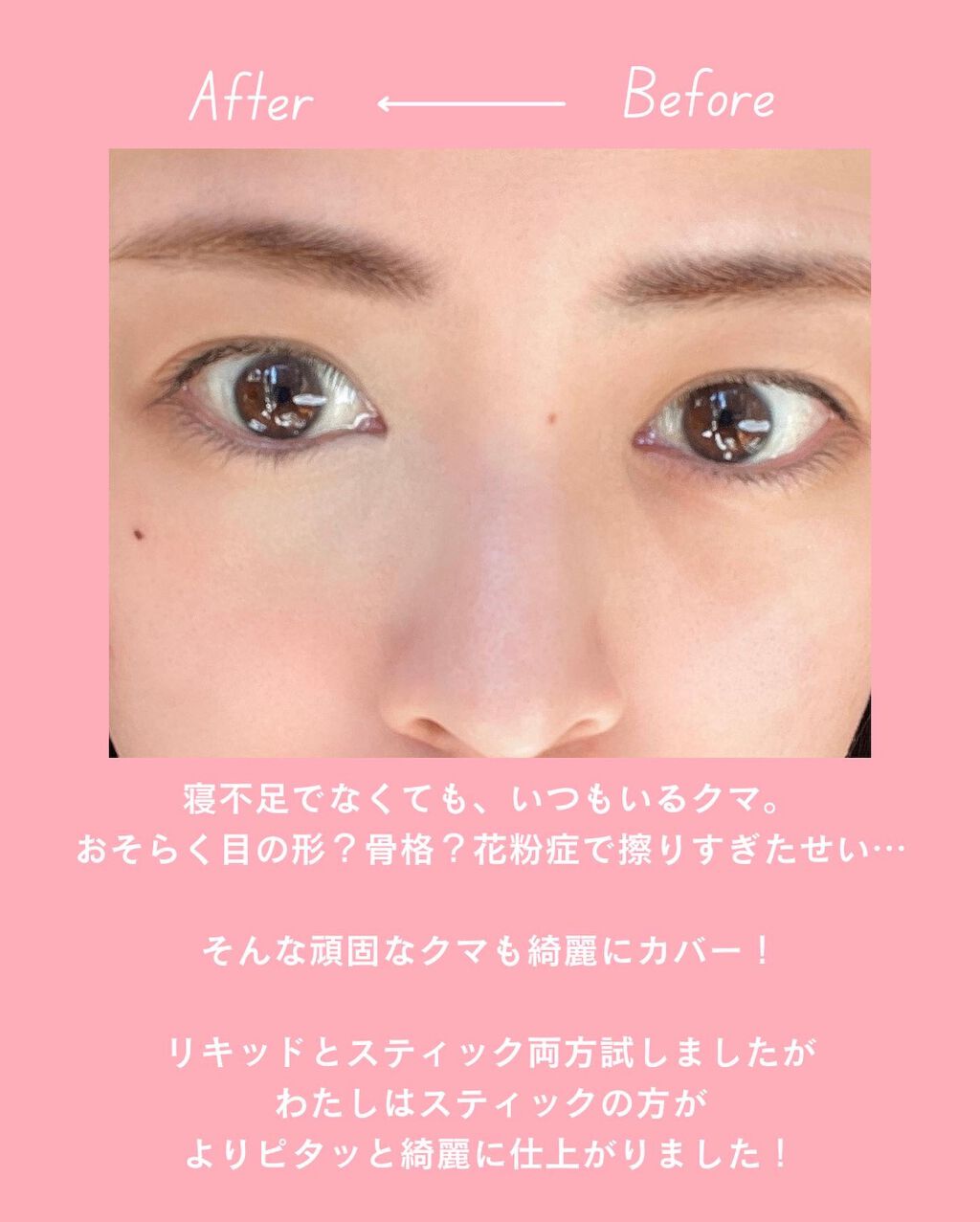 マスクフィットオールカバーデュアルコンシーラー/TIRTIR(ティルティル)/コンシーラーを使ったクチコミ（3枚目）