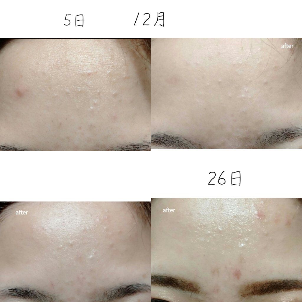 泡の洗顔料/カウブランド無添加/泡洗顔を使ったクチコミ（3枚目）