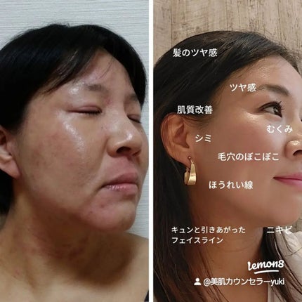 を使ったクチコミ(2枚目)