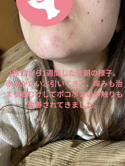 ホワイト クリーム ウォッシュ 20g(限定)/雪肌精/洗顔フォームの画像