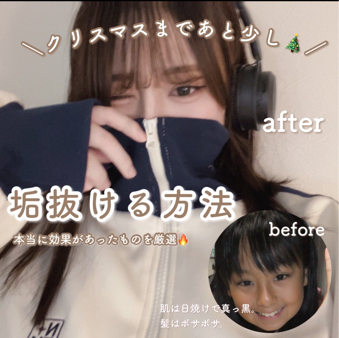 オードムーゲ 薬用ローション(ふきとり化粧水)/オードムーゲ/拭き取り化粧水を使ったクチコミ(1枚目)