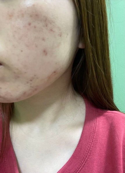 ディープクリア洗顔パウダー/ファンケル/洗顔パウダーを使ったクチコミ(3枚目)