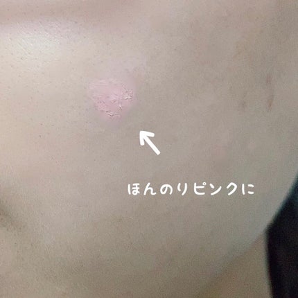 スポットパウダーエッセンス/ポツント/美容液を使ったクチコミ(2枚目)