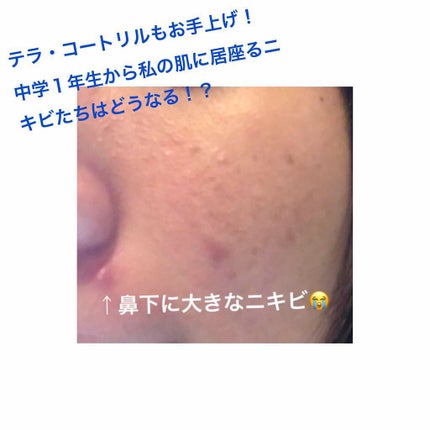 ウォッシャブル コールド クリーム/ちふれ/クレンジングクリームを使ったクチコミ(2枚目)