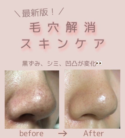 マツキヨ  セラミド化粧水/matsukiyo/化粧水を使ったクチコミ(1枚目)