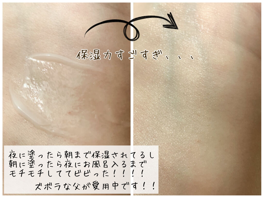 極潤 パーフェクトゲル/肌ラボ/オールインワン化粧品を使ったクチコミ（3枚目）