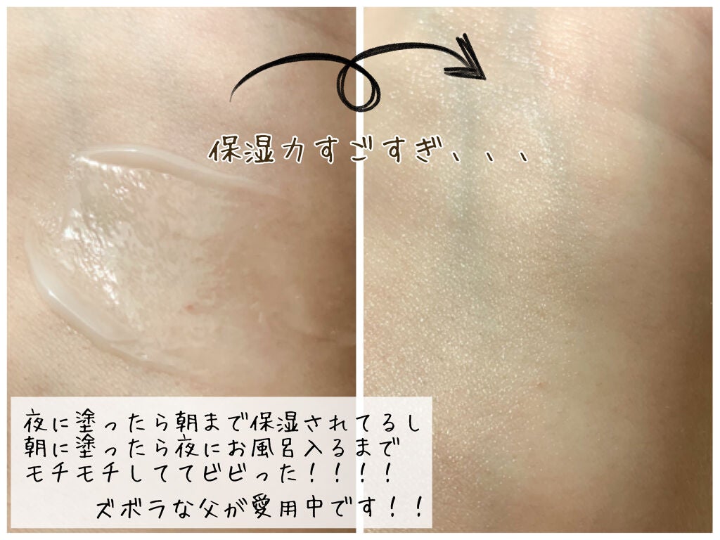 極潤 パーフェクトゲル/肌ラボ/オールインワン化粧品を使ったクチコミ(3枚目)