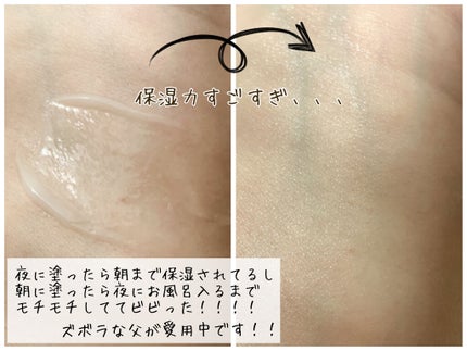 極潤 パーフェクトゲル/肌ラボ/オールインワン化粧品を使ったクチコミ(3枚目)