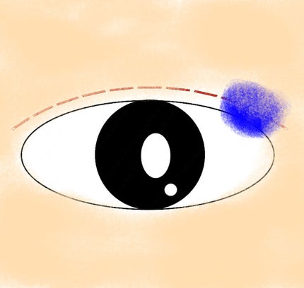 アイトーク/アイトーク/二重まぶた用アイテムを使ったクチコミ(2枚目)