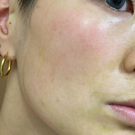 を使ったクチコミ(3枚目)