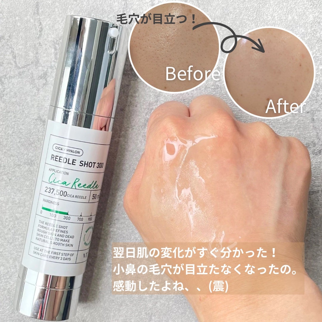 リードルショット300/VT/美容液を使ったクチコミ(5枚目)