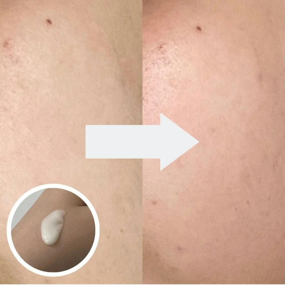 ユース ラディアンス ビタチノール セラム/primera/美容液を使ったクチコミ(3枚目)