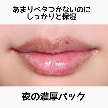 \ 寝る前にリップパック / 優秀ケア💄💋

キュレルに対する信頼が高すぎる私ですが、
リップケアもスゴすぎました😭

荒れてる人全員使ってみて欲しいです！
ただ、容器的に塗りにくいなって所が問題ですが
夜だけ！と考えると頑張れるかも？笑

キュレルのリップクリームでも
問題ないような気もするような……
今度リップクリームの方を買ってみようかな…


▫️Curel キュレル
リップケア バーム ￥1,320(税込)

⚠️こちらマイリトルボックスに
入っていた商品紹介となります


❌デメリット
・なんだか塗りにくい
・蓋が綺麗に閉まりにくい

️⭕️メリット
・保湿効果がすごい
・ベタつきがあまりない
・香りもリップクリームより控えめ
・敏感肌さんでも使える


ここまで読んでくれてありがとうございます🌟


参考になったらぜひ保存してください😊
フォローもよろしくお願いいたします！！
(フォロバさせてください💞)

#Curel #キュレル #敏感肌 #乾燥肌 #混合肌
#リップバーム #リップケアバーム #リップケア

の画像 その1