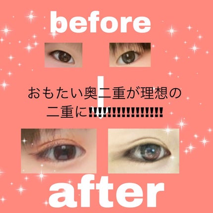 アイテープ(絆創膏タイプ、レギュラー、70枚)/DAISO/二重まぶた用アイテムを使ったクチコミ(1枚目)