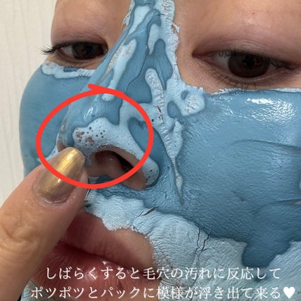 ゼロ毛穴パッド 2.0/MEDICUBE/トナーパッドを使ったクチコミ(5枚目)