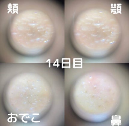 リードルショット100/VT/美容液を使ったクチコミ(8枚目)