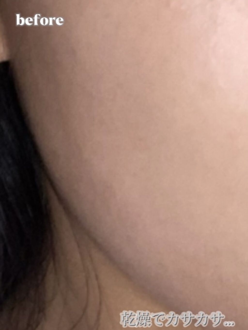 毛穴小町マスク		/クリアターン/シートマスク・パックを使ったクチコミ（2枚目）