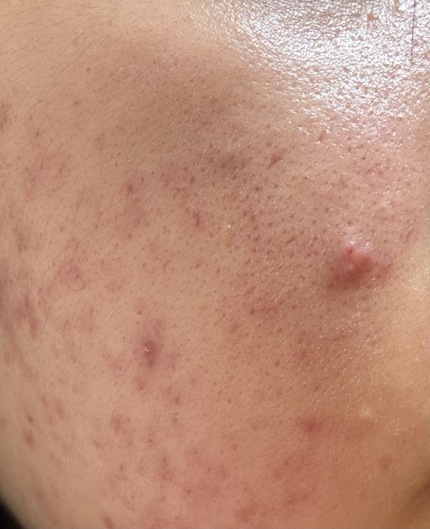 マジックカタツムリクリーム/ブラン/フェイスクリームを使ったクチコミ（1枚目）