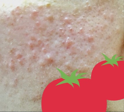 モイスチュア リポソーム/DECORTÉ/美容液を使ったクチコミ(1枚目)