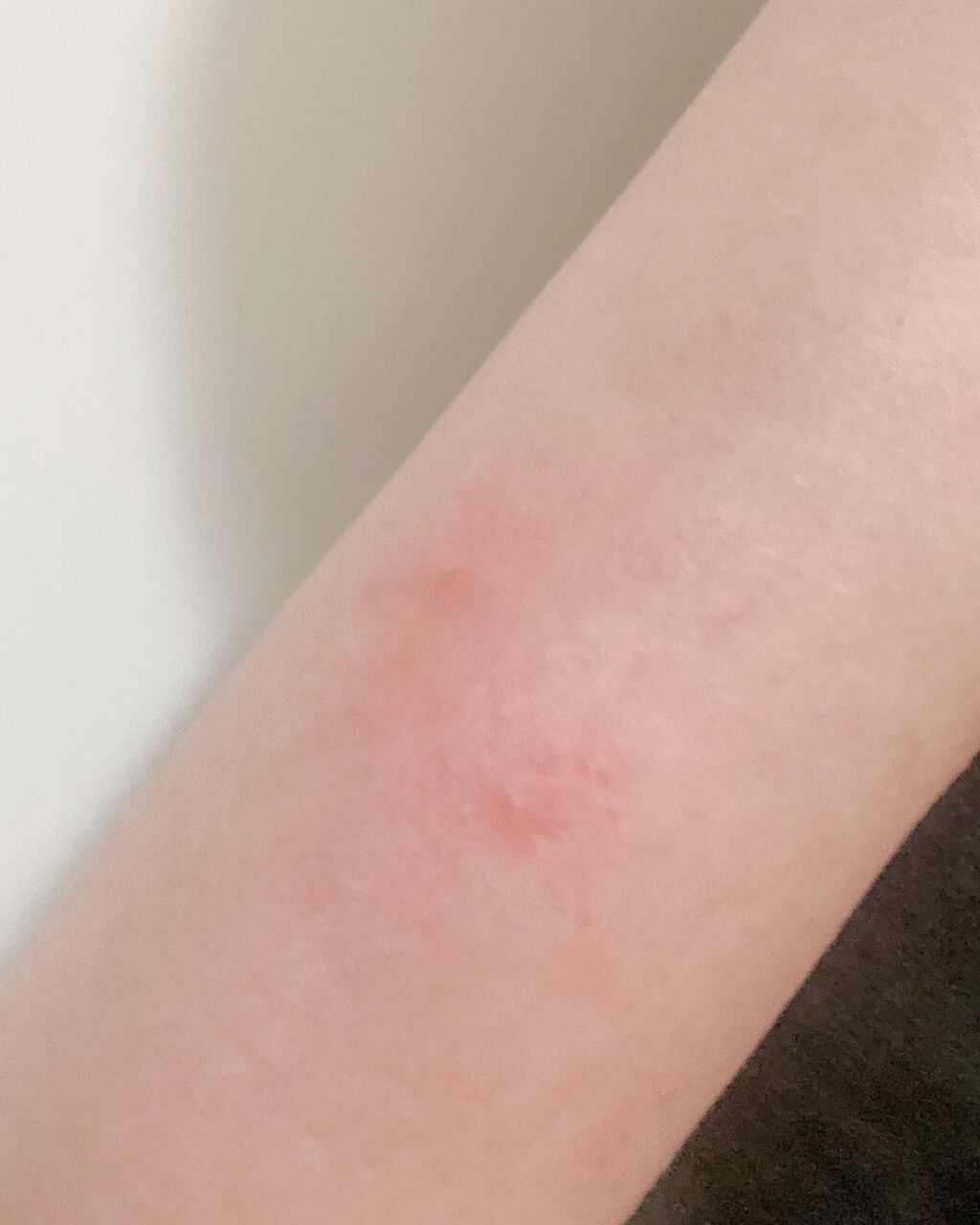 レチノールアドバンスドファーミングクリーム/ADVANCED CLINICALS/ボディクリームを使ったクチコミ(2枚目)