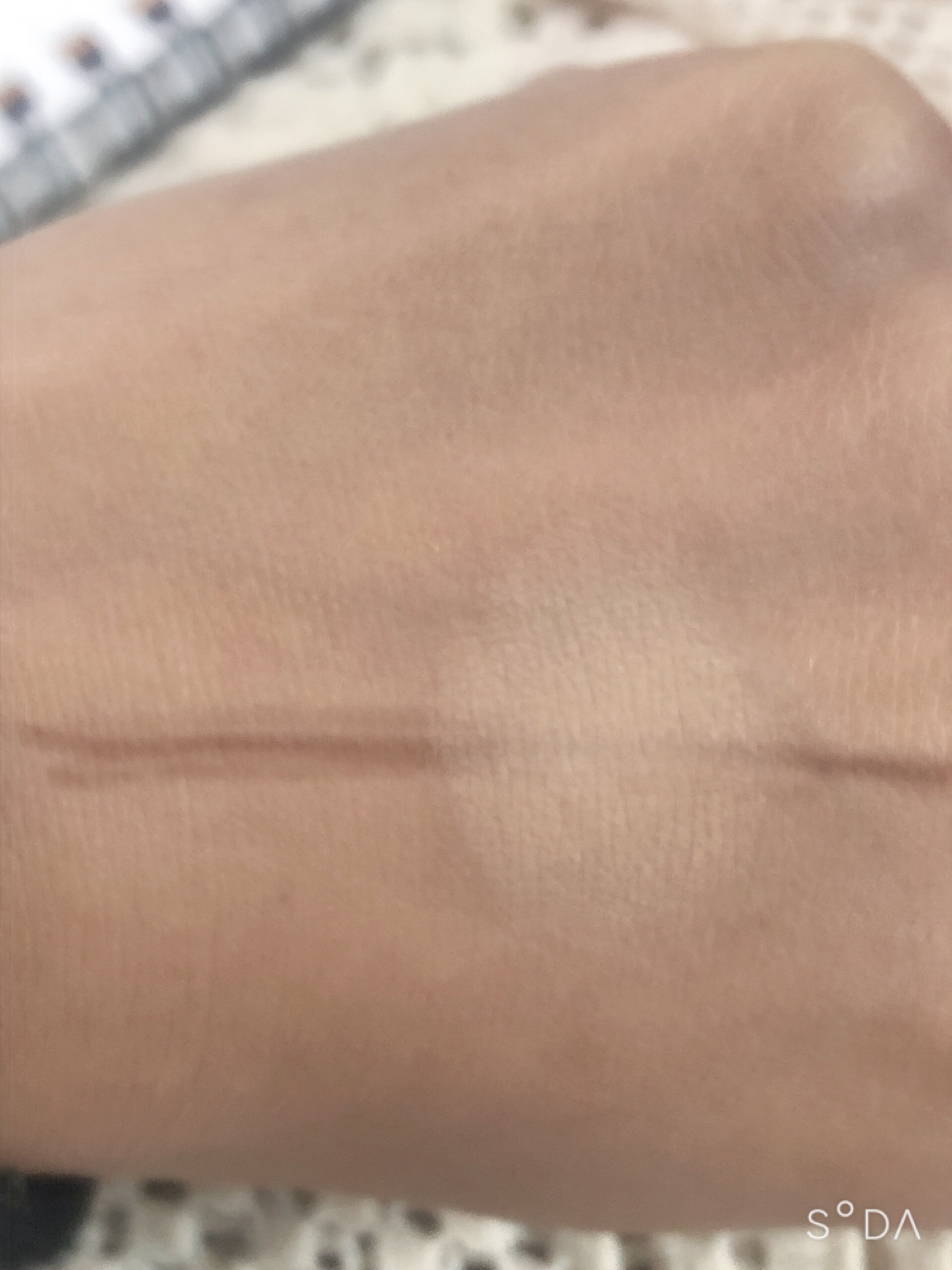 スポッツカバー ファウンデイション （ベースカラー）S100/SHISEIDO/クリームコンシーラーを使ったクチコミ（2枚目）