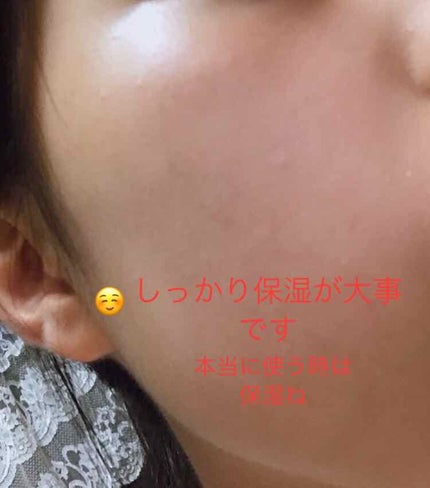 を使ったクチコミ(3枚目)