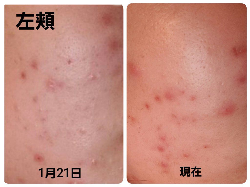 を使ったクチコミ（1枚目）