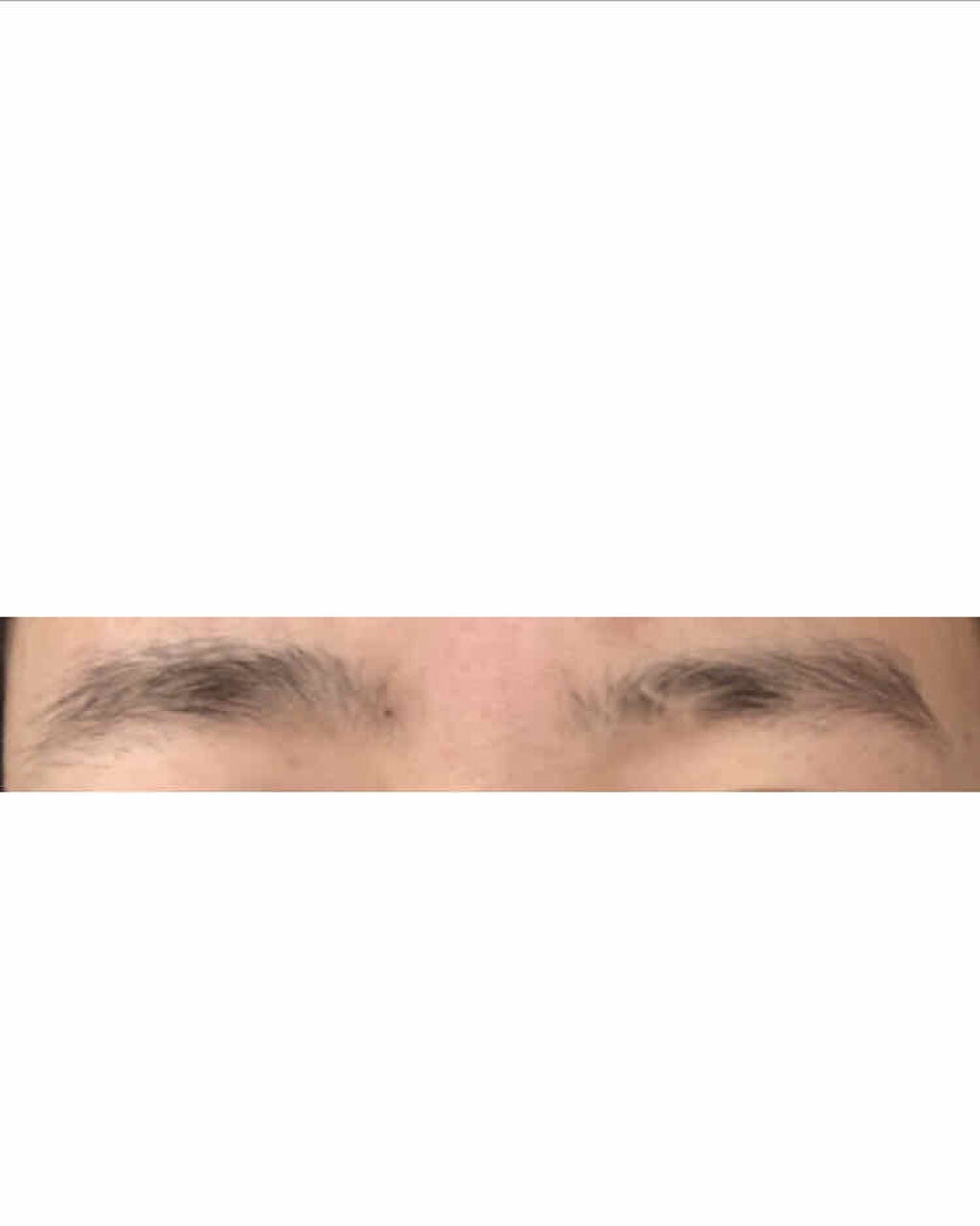 脱色クリーム 敏感肌用/エピラット/ムダ毛ケアを使ったクチコミ(2枚目)