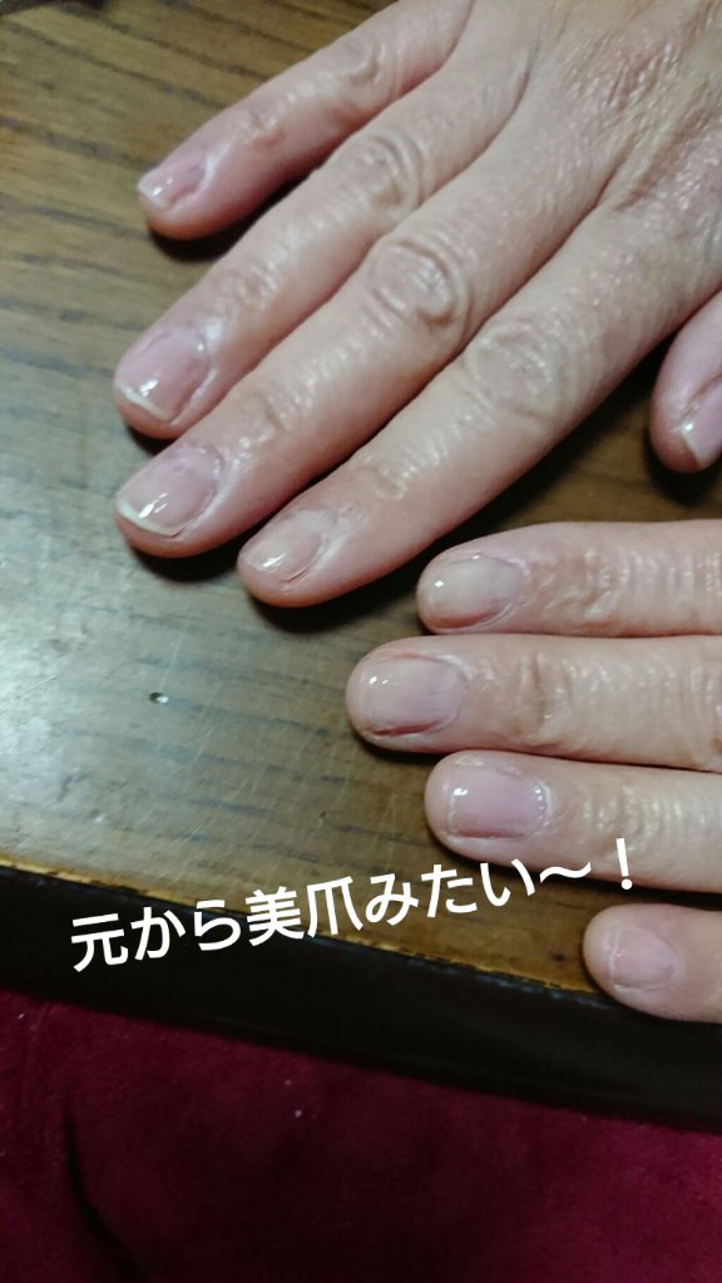 ディーアップファンデーション/D-UP/ネイルベースコートを使ったクチコミ（2枚目）