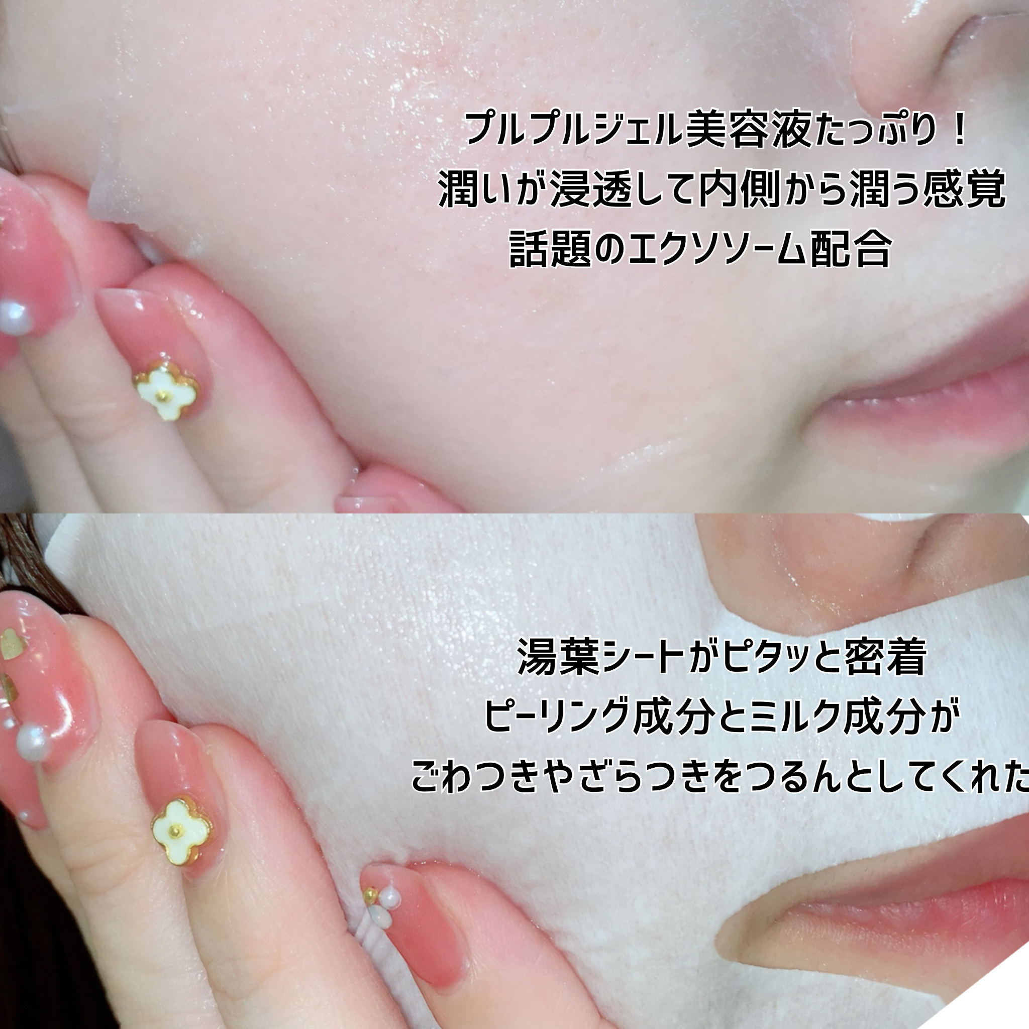 トリートメントリセットマスク/ALFACE+/シートマスク・パックを使ったクチコミ（3枚目）