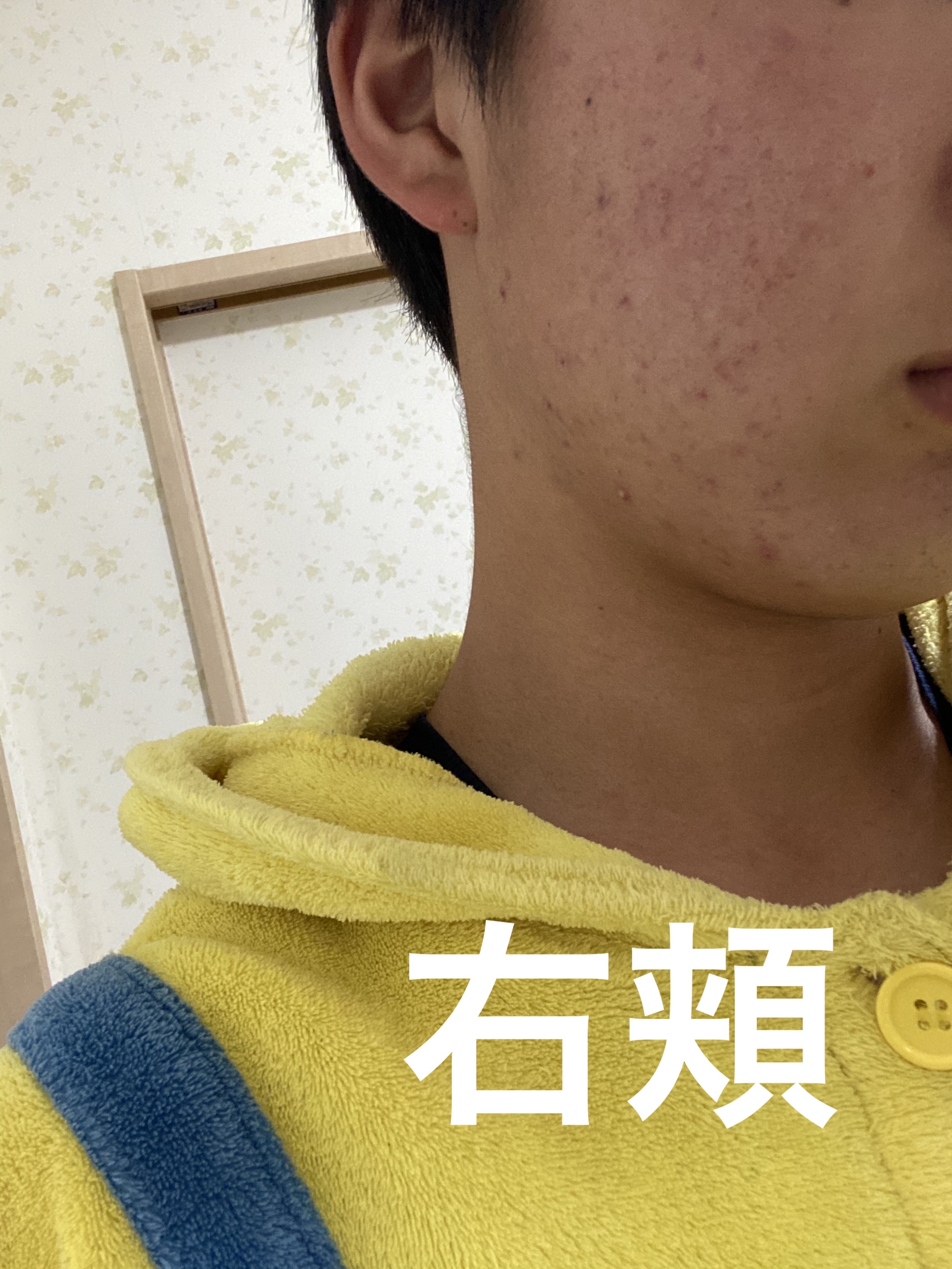 白潤プレミアム薬用浸透美白化粧水/肌ラボ/化粧水を使ったクチコミ（3枚目）