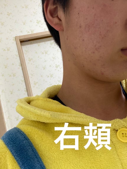 クリアウォッシュ/オルビス/洗顔フォームを使ったクチコミ(3枚目)