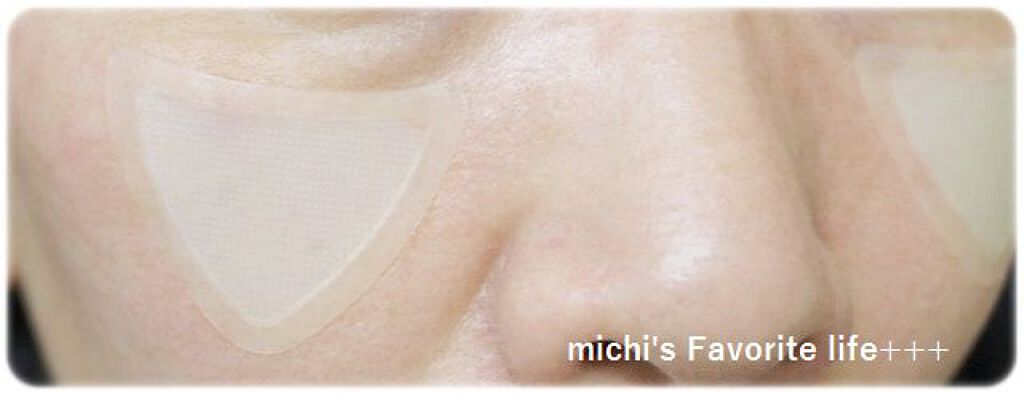 チークポアパッチ/北の快適工房/シートマスク・パックを使ったクチコミ(3枚目)