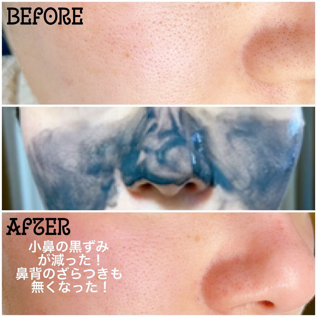 ソフィーナ iP ポア クリアリング ジェル ウォッシュ/SOFINA iP/その他洗顔料を使ったクチコミ(4枚目)