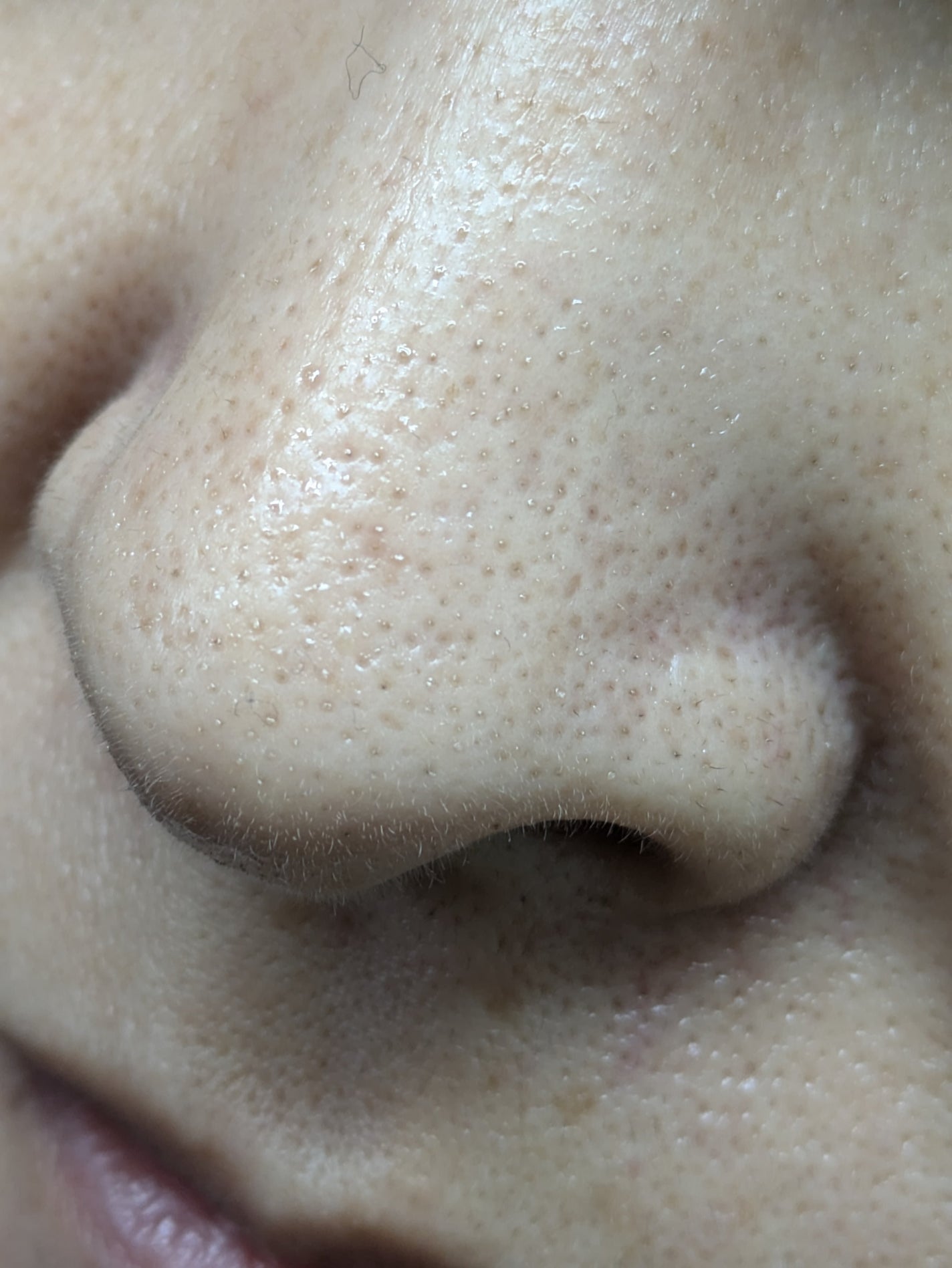 ブラックスネイルレチノールセラム/Dr.G/美容液を使ったクチコミ(2枚目)