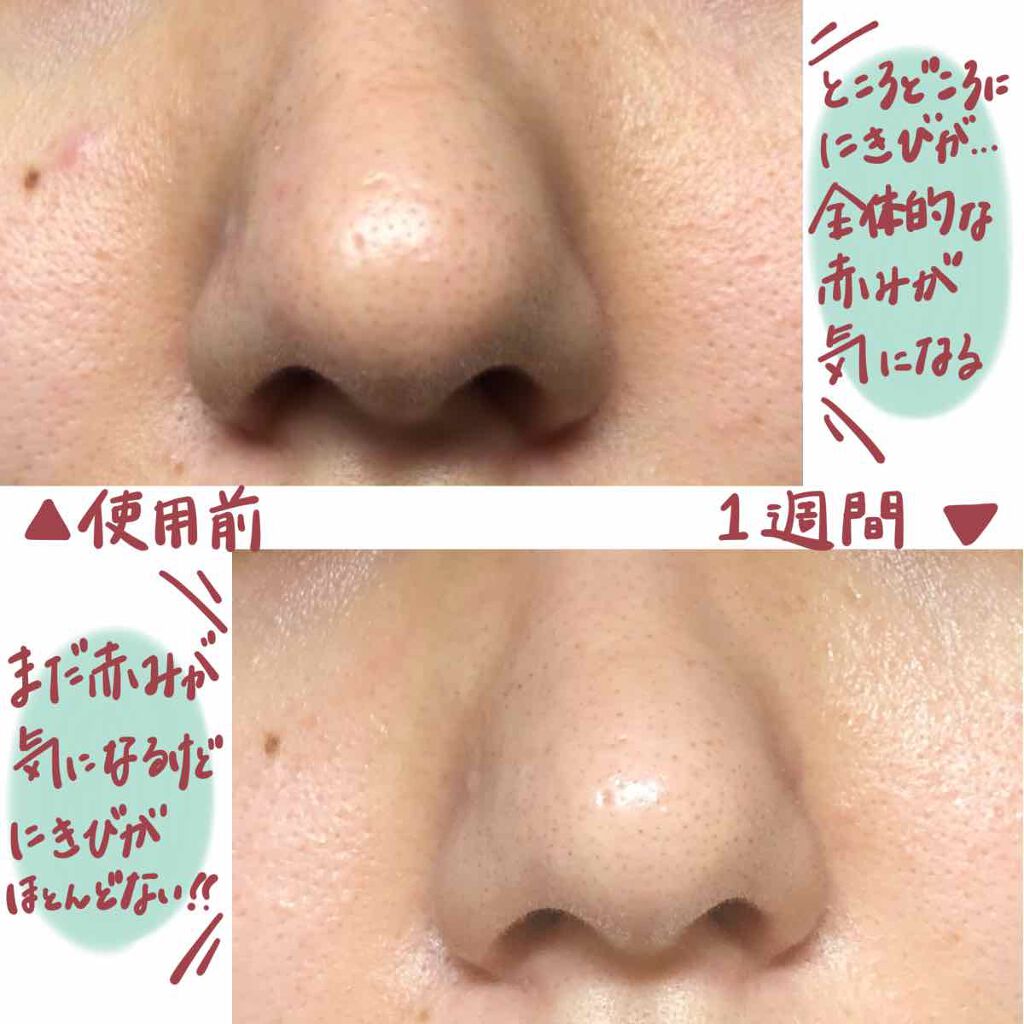 マデカクリーム/センテリアン24/フェイスクリームを使ったクチコミ(3枚目)