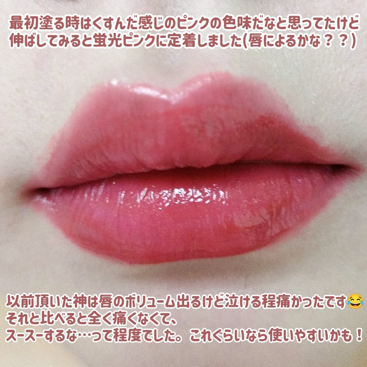 ドトムリッププラスプランパー/keybo/リッププランパーを使ったクチコミ(9枚目)