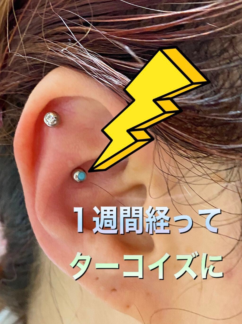 リサ・ラーソン♡クッションファンデマニア on LIPS 「今日は、前回より1週間様子みてからの何事もなく経過した事を確認..」(1枚目)