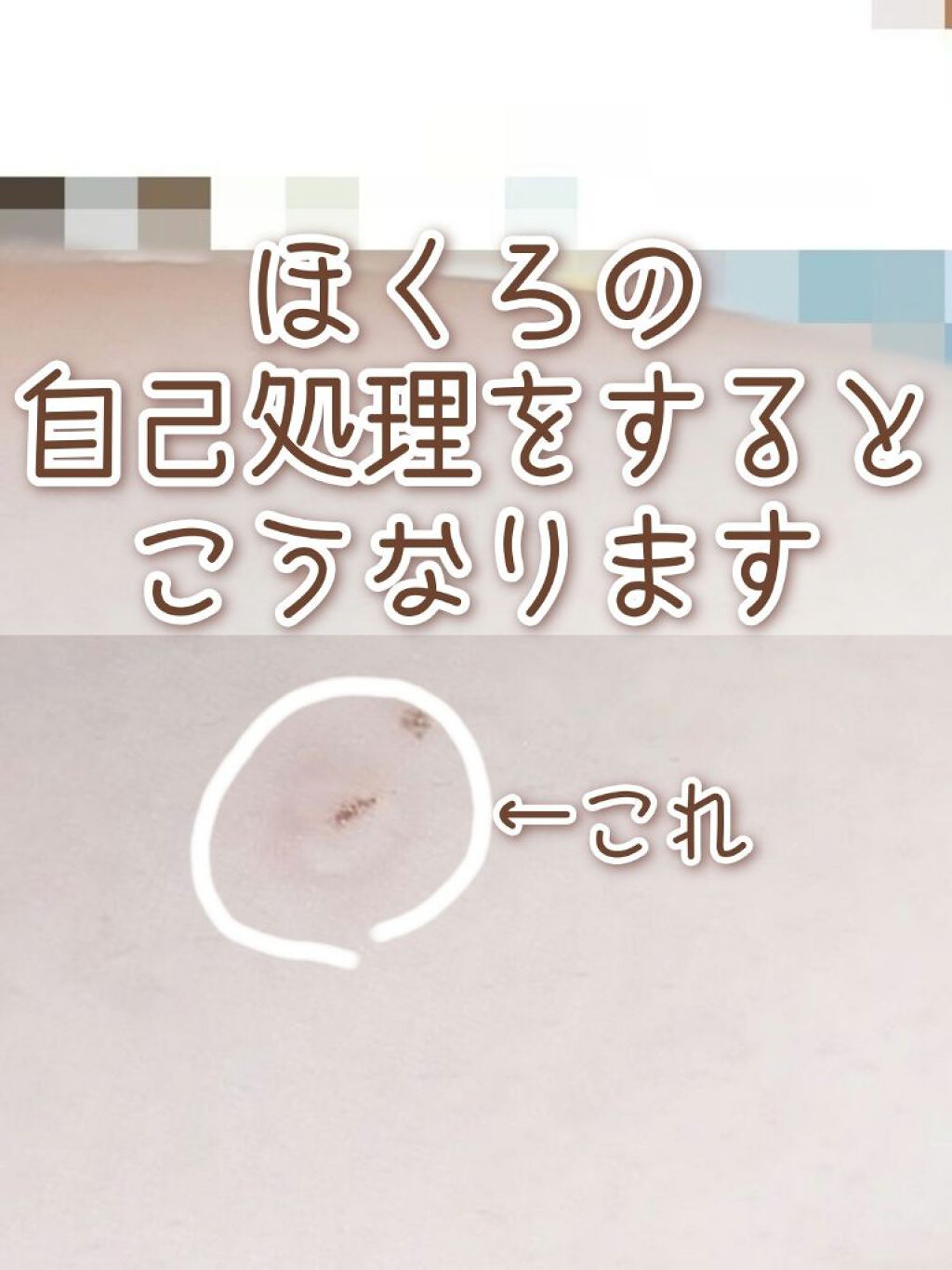 肌色タイプ/バンドエイド/その他を使ったクチコミ（1枚目）