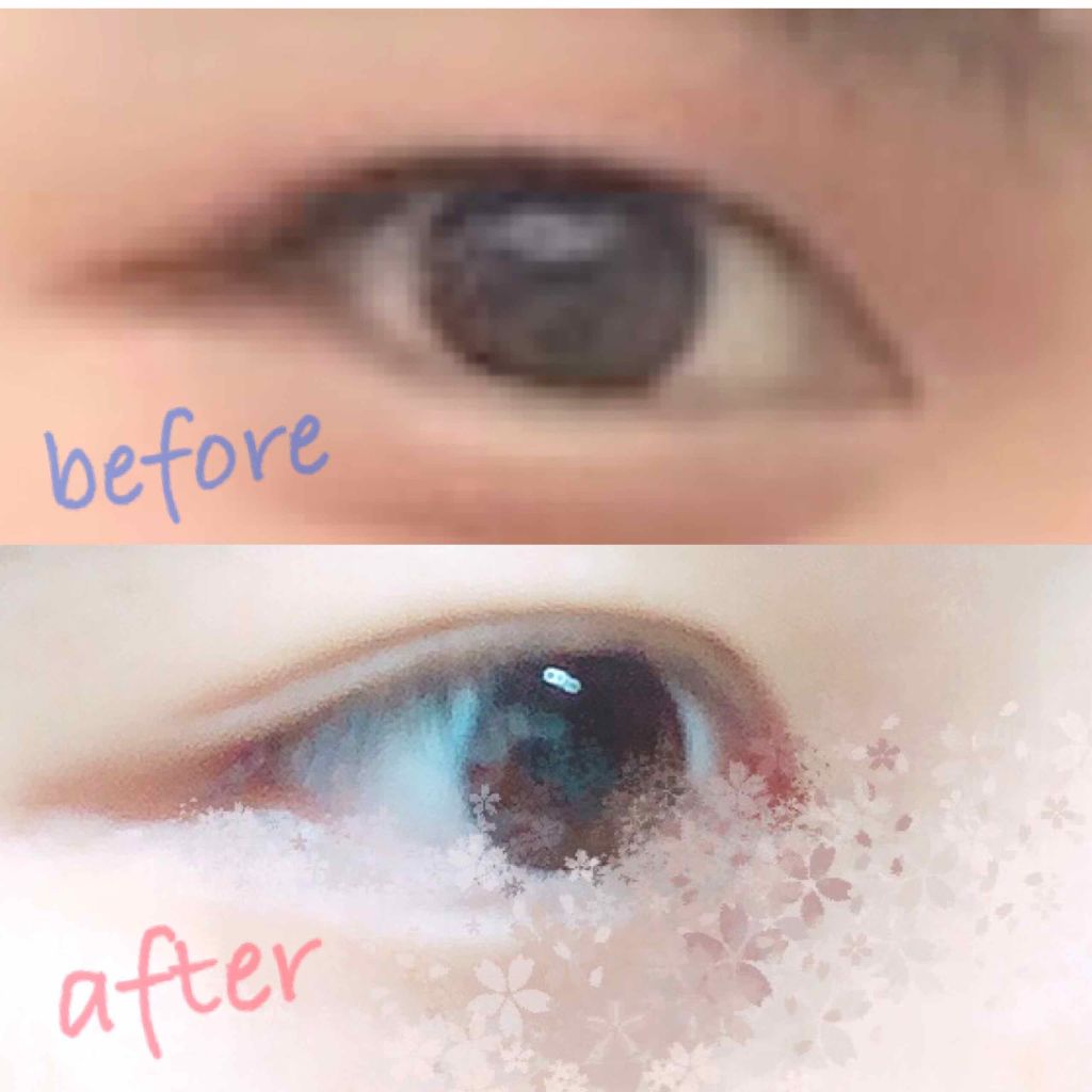 ワンダーアイリッドテープ Mild/D-UP/二重まぶた用アイテムを使ったクチコミ（2枚目）