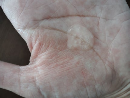 バランスフル シカセラム/Torriden/美容液を使ったクチコミ(2枚目)