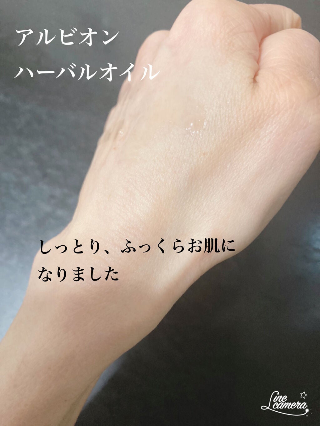 アルビオン 薬用スキンコンディショナー エッセンシャル/ALBION/化粧水を使ったクチコミ(4枚目)