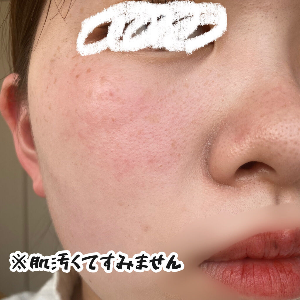 ハトムギ化粧水(ナチュリエ スキンコンディショナー R )/ナチュリエ/化粧水を使ったクチコミ（2枚目）